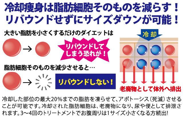 山口市エステ リンク クライオ 2ヘッドトップ画像4